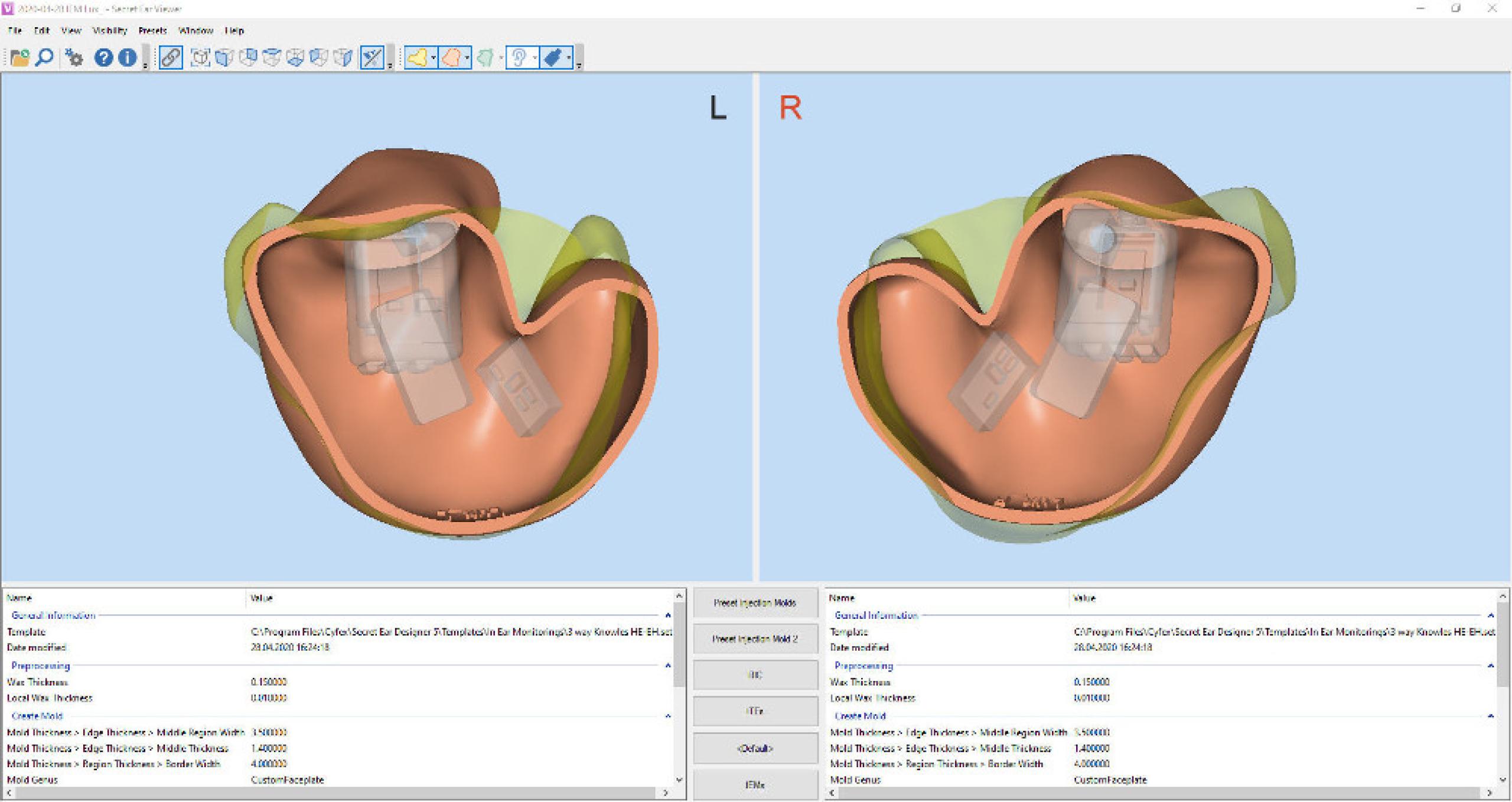 Screenshot Secret Ear Viewer